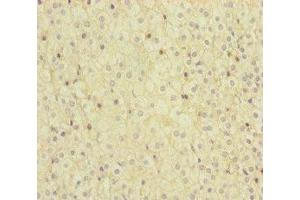 Immunohistochemistry of paraffin-embedded human adrenal gland tissue using ABIN7159656 at dilution of 1:100 (MMACHC antibody  (AA 63-282))