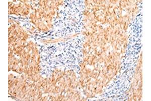 DMBT1 antibody