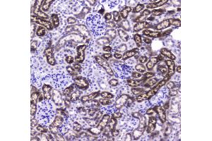 IHC analysis of CES1 using anti-CES1 antibody . (CES1 antibody  (AA 99-206))