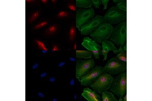ABIN6260295 and ABIN6279783 staining  cells by IF/ICC.