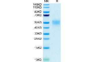 FCGR3B Protein (AA 17-200) (His-Avi Tag)