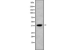 Western blot analysis of AWAT2 using HepG2 whole cell lysates (AWAT2 antibody  (Internal Region))