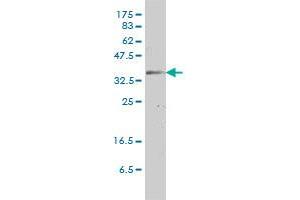 GJB3 monoclonal antibody (M01), clone 3B4-1B3 Western Blot analysis of GJB3 expression in HeLa . (Connexin 31 antibody  (AA 1-270))