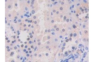 Detection of VAV3 in Human Kidney Tissue using Polyclonal Antibody to Vav 3 Oncogene (VAV3) (VAV3 antibody  (AA 398-583))
