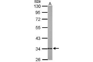 DECR1 antibody