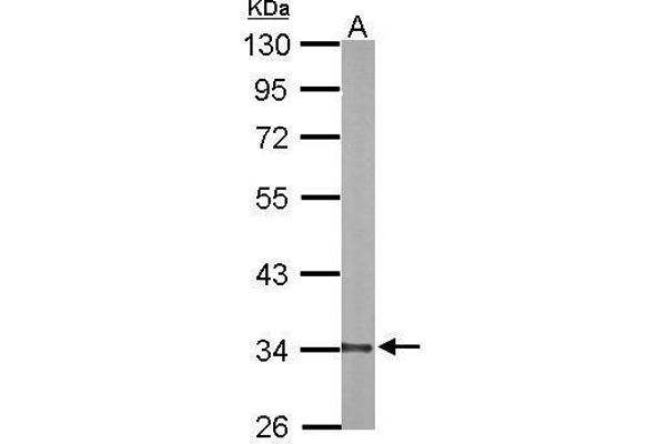 DECR1 antibody