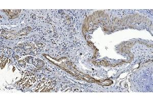 IHC analysis of Alpha B Crystallin/CRYAB using anti-Alpha B Crystallin/CRYAB antibody (ABIN7601209). (CRYAB antibody  (AA 30-151))