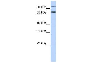 TAP1 antibody used at 1 ug/ml to detect target protein. (TAP1 antibody)