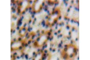 Used in DAB staining on fromalin fixed paraffin-embedded Kidney tissue (TGFB1I1 antibody  (AA 252-390))