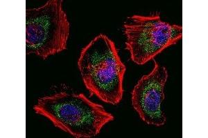 Fluorescent confocal image of HeLa cells stained with SOX4 antibody. (SOX4 antibody  (AA 86-114))