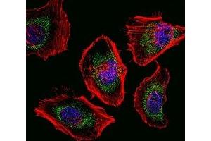 Fluorescent confocal image of HeLa cells stained with SOX4 antibody.