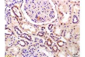 Formalin-fixed and paraffin embedded human kidney labeled with Anti-phospho-SCNN1B(Thr615) Polyclonal Antibody, Unconjugated (ABIN713456) at 1:200 followed by conjugation to the secondary antibody and DAB staining (SCNN1B antibody  (pThr615))