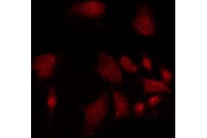 ABIN6275491 staining 293 by IF/ICC. (ARHGAP18 antibody  (Internal Region))