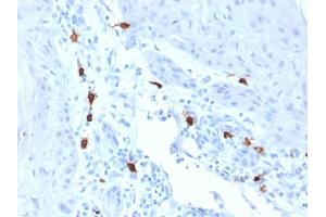 Formalin-fixed, paraffin-embedded human Skin stained with Tryptase Mouse Monoclonal Antibody (TPSAB1/1963). (TPSAB1 antibody  (AA 115-233))
