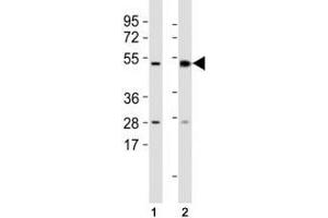 Western blot testing of Mlkl antibody at 1:1000 dilution and mouse samples: (1) lung, (2) spleen lysate; Predicted size: 54 kDa. (MLKL antibody  (AA 444-472))