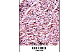 DHRS7C Antibody immunohistochemistry analysis in formalin fixed and paraffin embedded human heart tissue followed by peroxidase conjugation of the secondary antibody and DAB staining. (DHRS7C antibody  (AA 116-145))