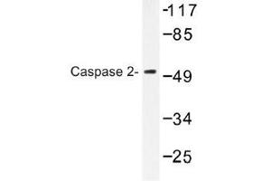 Image no. 1 for anti-Caspase 2, Apoptosis-Related Cysteine Peptidase (CASP2) antibody (ABIN317792) (Caspase 2 antibody)