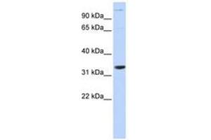 Image no. 1 for anti-Acidic (Leucine-Rich) Nuclear phosphoprotein 32 Family, Member B (ANP32B) (AA 36-85) antibody (ABIN6741124)
