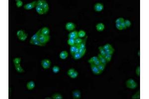 Immunofluorescence staining of HepG2 cells with ABIN7159581 at 1:100, counter-stained with DAPI. (METAP2 antibody  (AA 313-449))