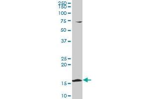 PPIL1 polyclonal antibody (A01), Lot # 060524JCS1 Western Blot analysis of PPIL1 expression in K-562 . (PPIL1 antibody  (AA 76-166))