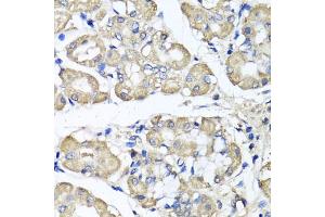 Immunohistochemistry of paraffin-embedded human stomach using BCS1L antibody. (BCS1L antibody)