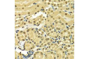 Immunohistochemistry of paraffin-embedded Mouse kidney using HNRNPA2B1 antibody at dilution of 1:100 (x400 lens). (HNRNPA2B1 antibody  (AA 1-180))