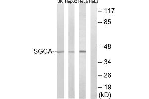 Western blot analysis of extracts from Jurkat cells, HepG2 cells and HeLa cells, using SGCA antibody. (SGCA antibody  (Internal Region))
