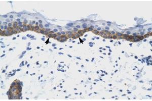 Human Skin (NUDT9 antibody  (C-Term))