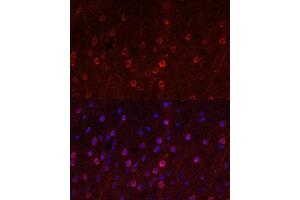 Immunofluorescence analysis of rat brain using SLC1 antibody (ABIN6131630, ABIN6147868, ABIN6147869 and ABIN6219899) at dilution of 1:100. (SLC1A1 antibody  (AA 430-524))