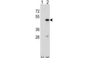 Western Blotting (WB) image for anti-RNA Binding Motif Protein 22 (RBM22) antibody (ABIN2998337) (RBM22 antibody)