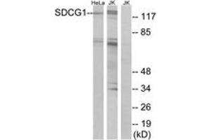 Western blot analysis of extracts from HeLa/Jurkat cells, using SDCG1 Antibody. (NEMF antibody  (AA 881-930))