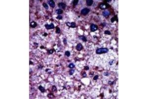 Image no. 2 for anti-phosphofructokinase, Muscle (PFKM) (N-Term) antibody (ABIN360632) (PFKM antibody  (N-Term))