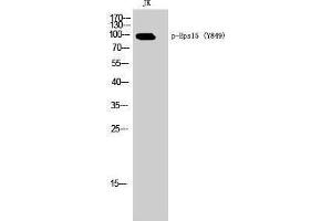 Western Blotting (WB) image for anti-Epidermal Growth Factor Receptor Pathway Substrate 15 (EPS15) (pTyr849) antibody (ABIN3182362) (EPS15 antibody  (pTyr849))