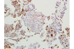 Formalin-fixed and paraffin embedded rat lung labeled with Anti-GPNMB/Osteoactivin Polyclonal Antibody, Unconjugated  at 1:200 followed by conjugation to the secondary antibody and DAB staining. (Osteoactivin antibody  (AA 81-180))