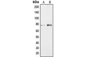 Western blot analysis of BRF1 expression in Jurkat (A), NIH3T3 (B) whole cell lysates. (BRF1 antibody  (Center))