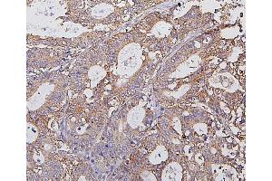 IHC analysis of Hexokinase 1/HK1 using anti-Hexokinase 1/HK1 antibody (ABIN7600260). (Hexokinase 1 antibody  (AA 17-323))