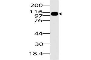 Image no. 1 for anti-DEAD (Asp-Glu-Ala-Asp) Box Polypeptide 58 (DDX58) (AA 1-220) antibody (ABIN5027275) (DDX58 antibody  (AA 1-220))
