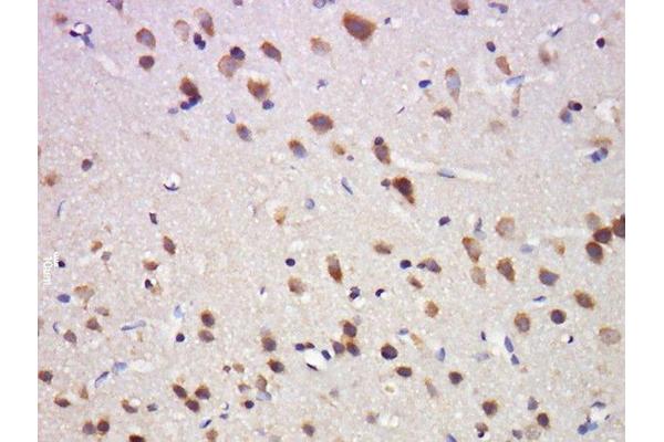 OPRD1 antibody  (pSer363)