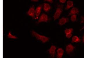 ABIN6269009 staining LOVO by IF/ICC. (SLC2A3 antibody  (C-Term))