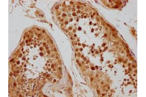 IHC image of ABIN7152321 diluted at 1:300 and staining in paraffin-embedded human testis tissue performed on a Leica BondTM system. (Exportin 2 antibody  (AA 713-971))