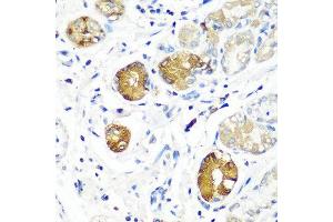 Immunohistochemistry of paraffin-embedded human stomach using SGSH antibody at dilution of 1:100 (40x lens). (SGSH antibody)