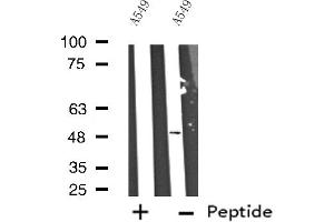 Western blot analysis of extracts from A549 cells, using Cytochrome P450 17A1 antibody.