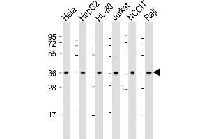 All lanes : Anti-OGG1 Antibody (C-term) at 1:2000 dilution Lane 1: Hela whole cell lysate Lane 2: HepG2 whole cell lysate Lane 3: HL-60 whole cell lysate Lane 4: Jurkat whole cell lysate Lane 5: NCCIT whole cell lysate Lane 6: Raji whole cell lysate Lysates/proteins at 20 μg per lane. (OGG1 antibody  (C-Term))