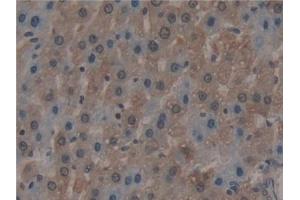Detection of MX1 in Rat Liver Tissue using Polyclonal Antibody to Myxovirus Resistance 1 (MX1) (MX1 antibody  (AA 68-303))