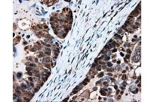 Immunohistochemical staining of paraffin-embedded Kidney tissue using anti-HSPA1A mouse monoclonal antibody. (HSP70 1A antibody)