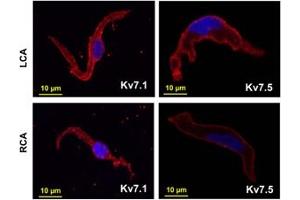 Expression of KCNQ1 (KV7.