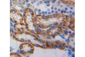 Used in DAB staining on fromalin fixed paraffin-embedded Kidney tissue (NDUFAB1 antibody  (AA 3-129))