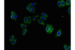 Immunofluorescent analysis of HepG2 cells using ABIN7157756 at dilution of 1:100 and Alexa Fluor 488-congugated AffiniPure Goat Anti-Rabbit IgG(H+L) (KMO antibody  (AA 1-486))