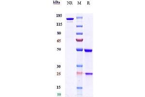 Anti-BTN3A1 Reference Antibody (CTX-2026) on SDS-PAGE under reducing (R) condition.