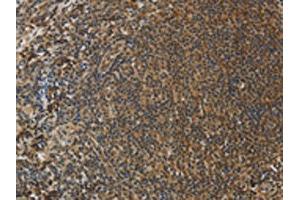 The image on the left is immunohistochemistry of paraffin-embedded Human tonsil tissue using ABIN7130557(PCP4 Antibody) at dilution 1/50, on the right is treated with fusion protein. (PCP4 antibody)
